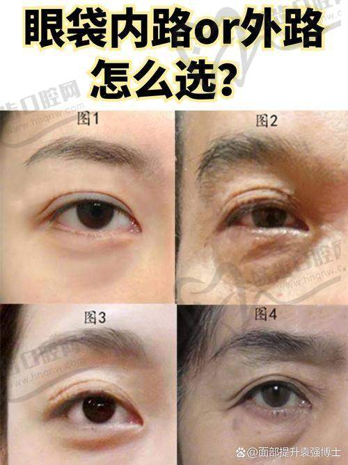 沈阳百嘉丽整形医院是正规医院吗？真实成效到底怎么样？  