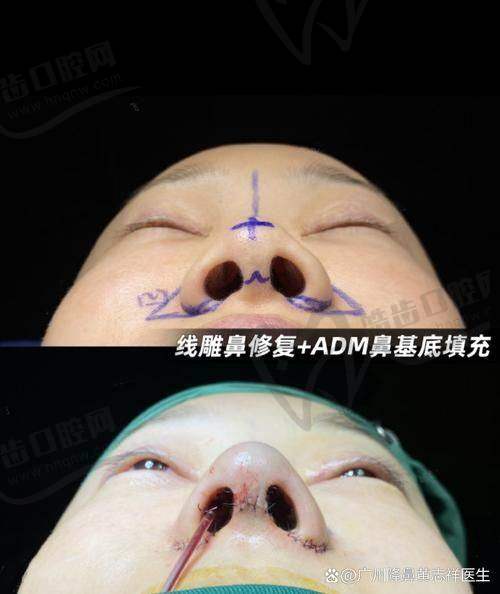 文丰院长擅长项目