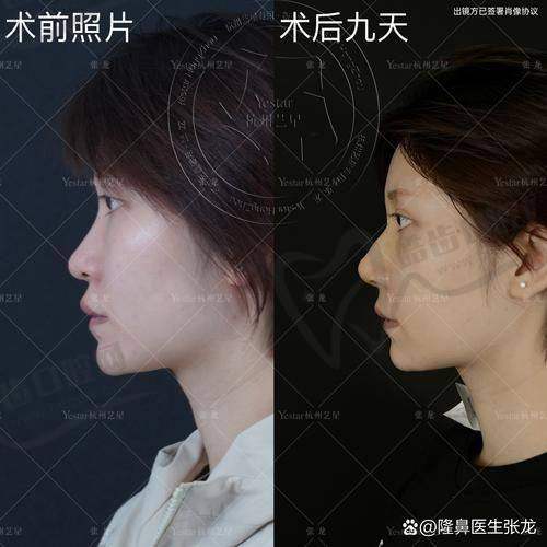 文丰院长技术优势