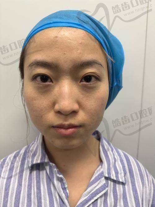曾宪猛医生预约挂号