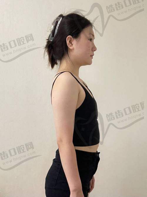 总结：沈阳百嘉丽整形医院是正规医院吗？当然靠谱！  