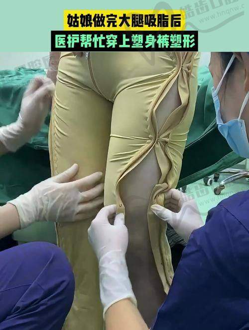 昆明韩辰王德宁大腿吸脂19800元起，精细塑形，术后恢复快，效果持久自然