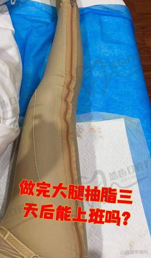 四、昆明韩辰王德宁大腿吸脂的优势