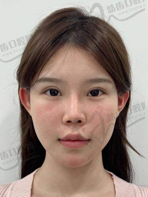 广州海峡医疗美容医院与王玉燕医生简介
