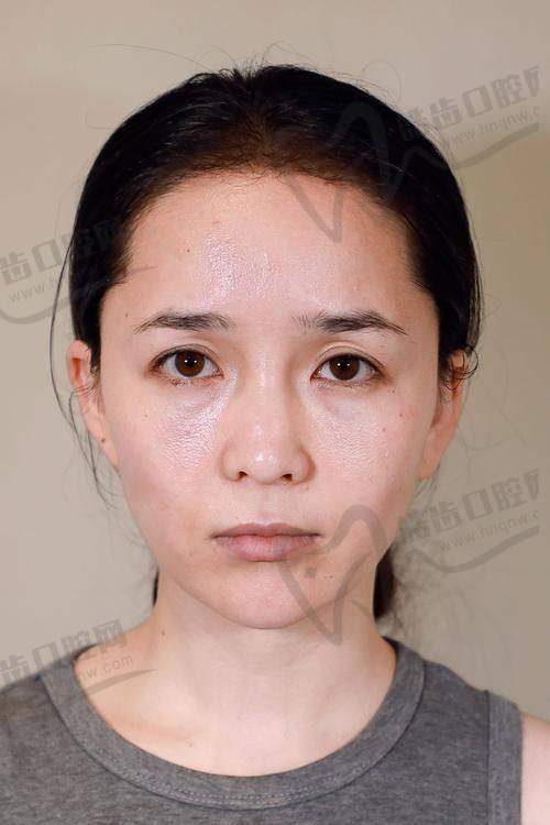 求美者的真实评价