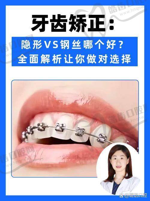 金属自锁托槽矫正是什么？