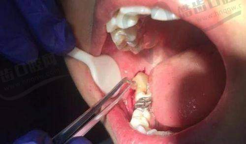 临汾凯尔口腔门诊部特色项目及技术优势