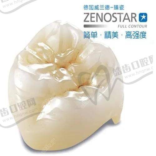 珠海诺贝尔口腔的优势在哪里？