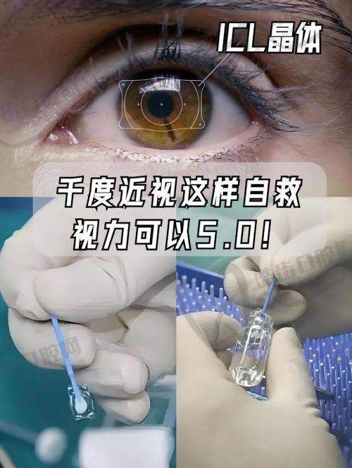 翟国光医生口碑评价及真人实例