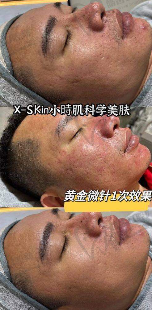 结语