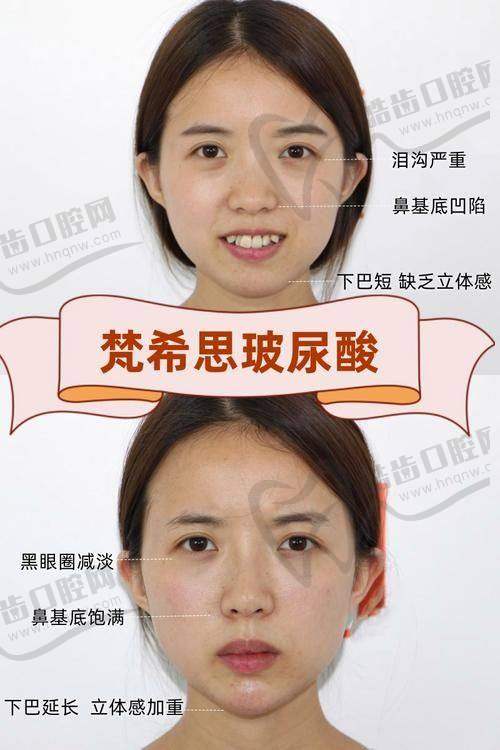 为什么大家都关心李花停医生在哪个医院？