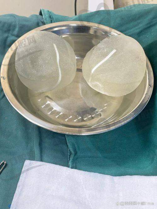昆明韩辰陈宁做曼托假体隆胸20000元起，术后自然美观医生经验丰富超安心！