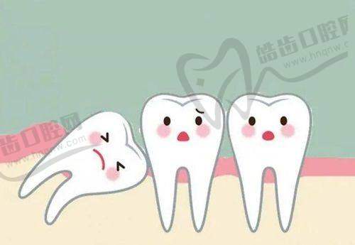 口腔项目价格影响因素科普
