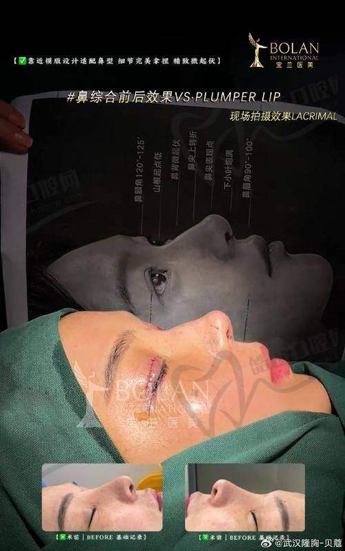 杭州未来科技城医院医美中 心真人口碑评价怎么样？