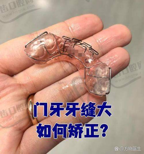 海宁市人民医院口腔科简介概述