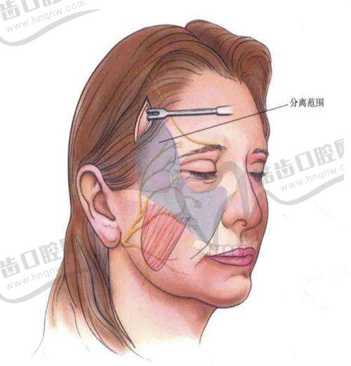 结语:西安徐智慧医生收费标准透明,品质服务值得信赖