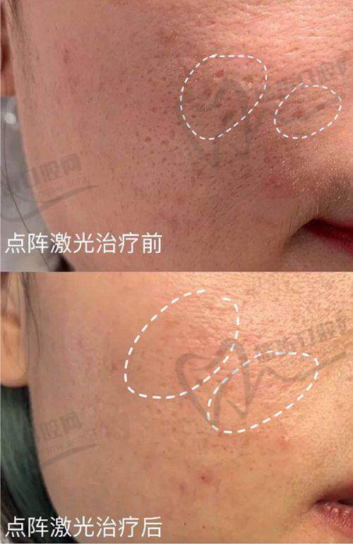 患者真实反馈：修复成功几率高达89%