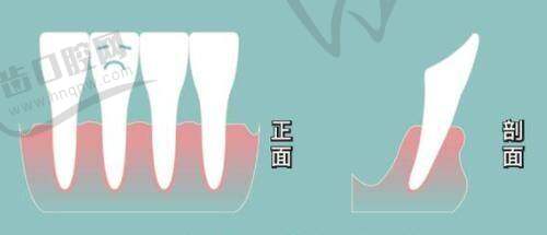 郑小红毫米精修技术优势在哪