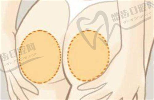 坐诊时间安排:预约制为主,建议提前联系医院