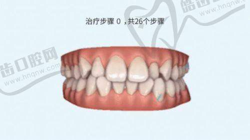 柯正建医生：无锡口腔医院崇文门诊部的牙体骨干医生