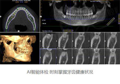 无锡爱牙口腔门诊部口碑好不好？附真实患者口碑评价