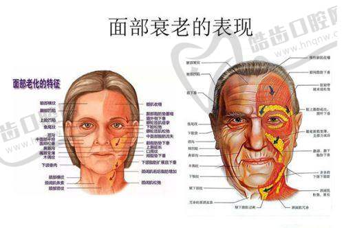 徐智慧医生简介:微整注射领域的实力派医生