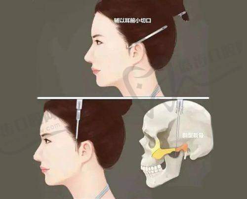 徐智慧医生热门项目推荐与价格参考