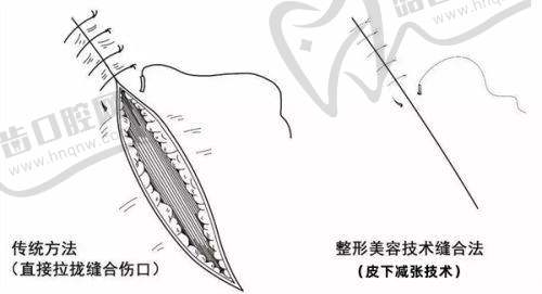 医生团队专精可靠，技术实力不容小觑