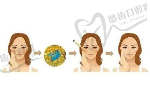 项目多样，满足不同求美需求
