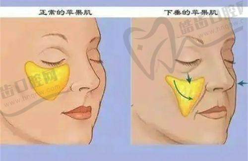 口碑争议：个别投诉存在，但无重大医疗事故