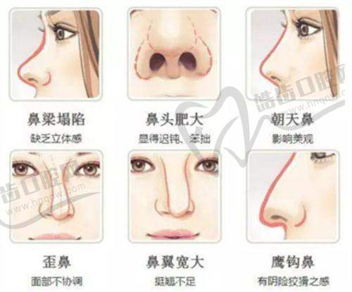 兰州皙妍丽适合哪些求美者？