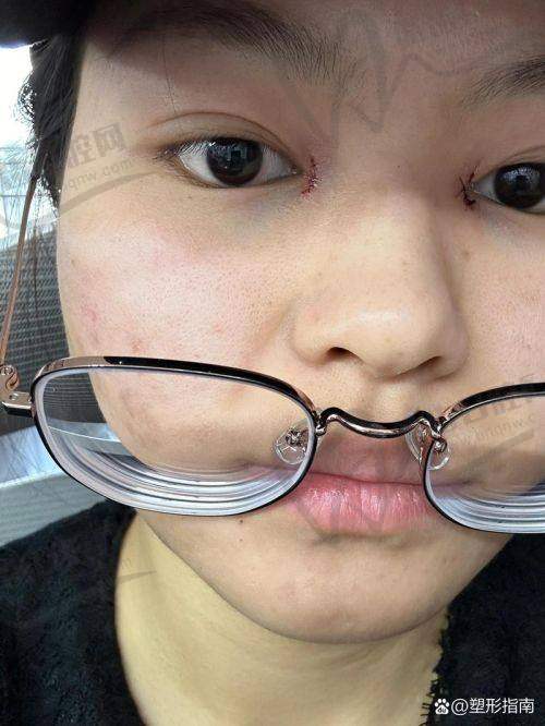 杭州美莱整形孟晨曦医生预约挂号