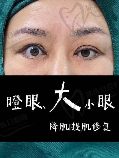 杭州美莱整形孟晨曦医生擅长项目