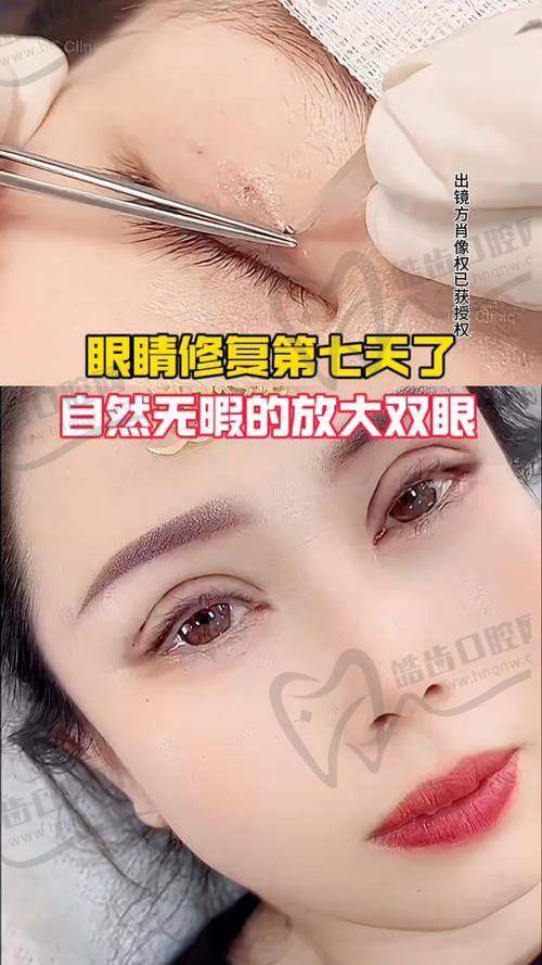 董瑞芳医生出诊时间和预约方式：怎么挂号更方便？