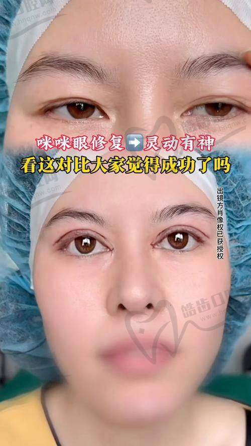 刘月丽：注重精细化操作，自然风格优选，性价比高