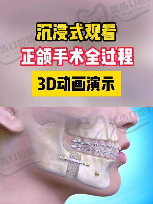 关于价格，这技术到底贵不贵？值不值？