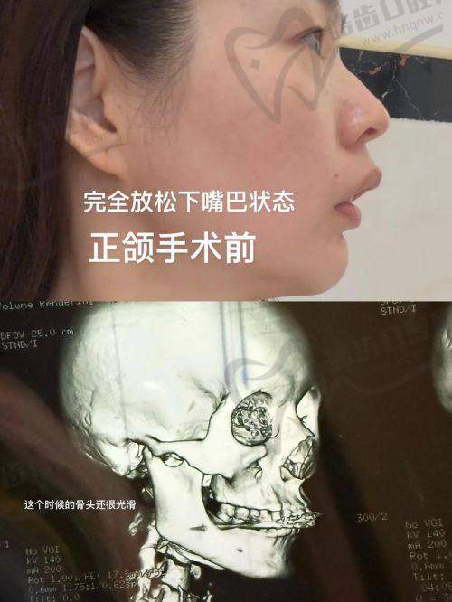 何锦泉医生在广州的地位到底怎样？靠谱程度有多高？