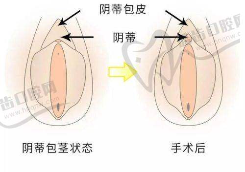 杭州红房子妇产医院私密整形修复中 心地址电话营业时间
