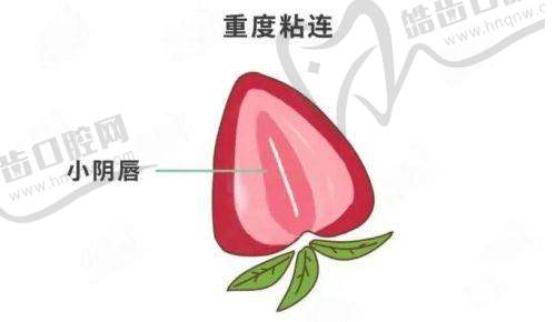 杭州红房子妇产医院私密整形修复中 心特色项目及技术优势
