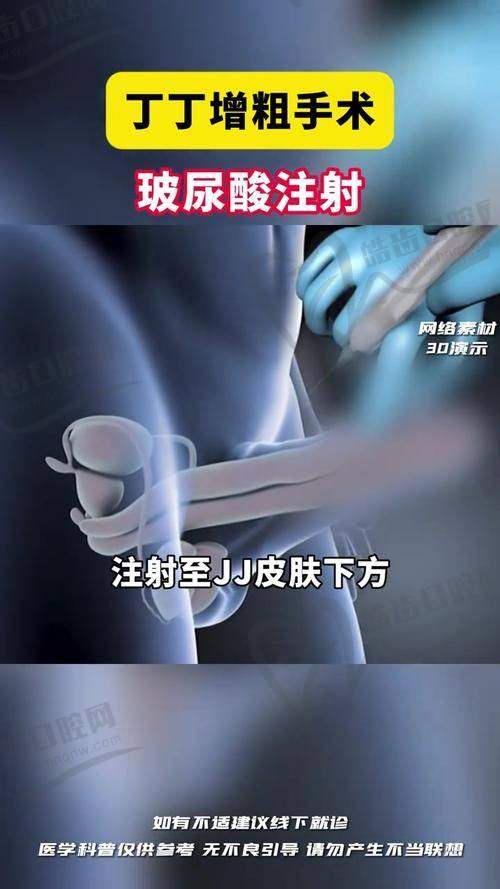 杭州红房子妇产医院私密整形修复中 心真人口碑评价怎么样？