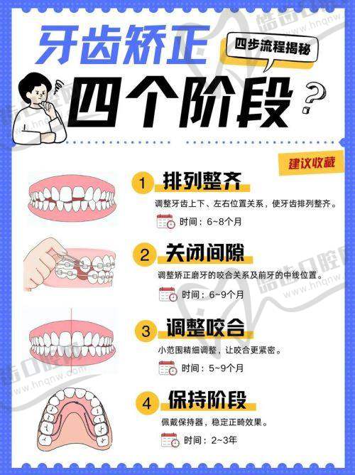 美学修复与贴面项目交钱值不值？