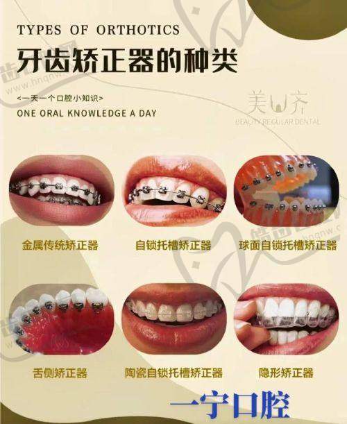 无锡雅善口腔门诊部价格表