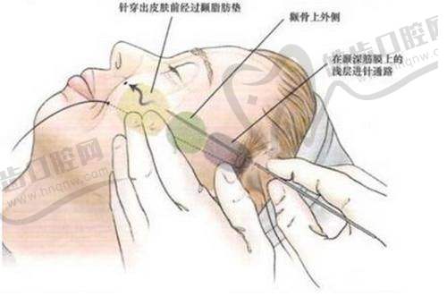 张海明怎么预约？