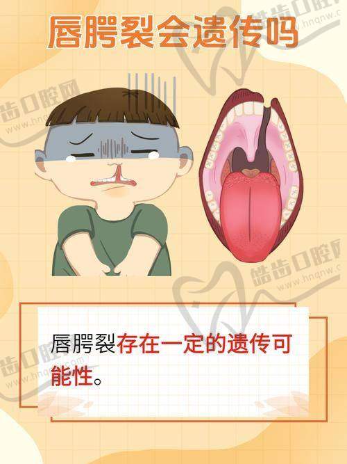 毋巨龙医生做唇腭裂修复有哪些过人技术？手术细节全方面拆解