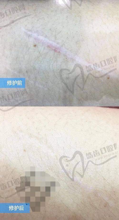 综合套餐与定制修复类