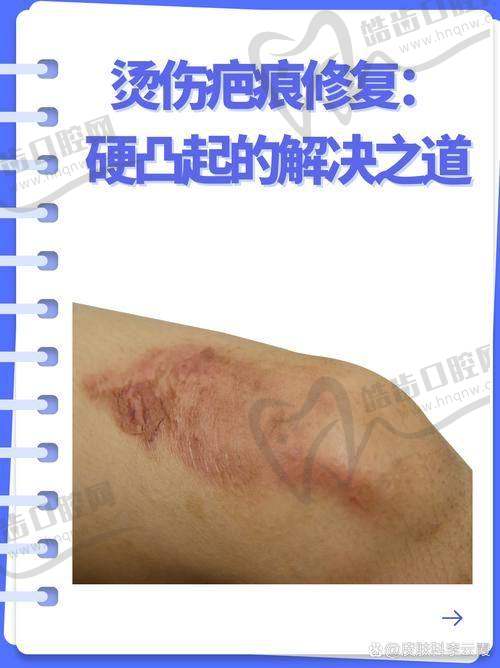 北京广济疤痕医院收费价格表