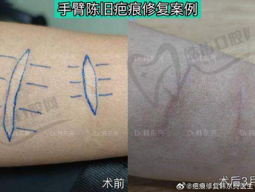 丰台广济医院疤痕修复医院技术与实力展示