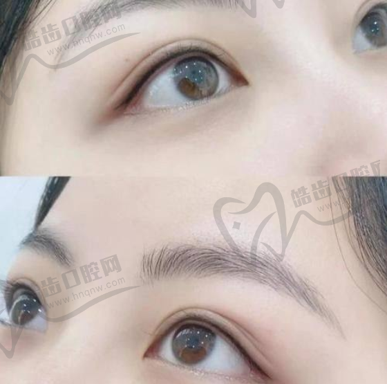 佳富美：郑小红医生坐诊详情
