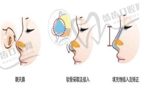杭州未来科技城医院医美中心怎么样？民营三级院+轻医美团队口碑获阿里员工青睐