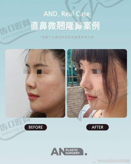 长春绿园铭誉医疗美容诊所特色项目及技术优势